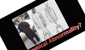 anatomical abnormality front icon